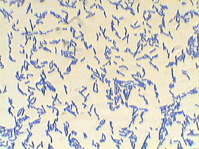 bacillus megaterium acid fast stain