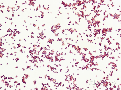 Gram Negative Cocci In Clusters