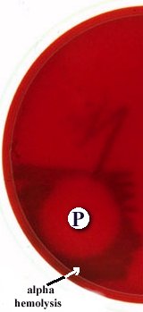 Taxo P Disc Sensitivity Test Results: The organism is sensitive to the P disc